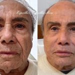 Stenio Garcia surpreendeu o público com o resultado de sua harmonização facial recente. (Foto Instagram)