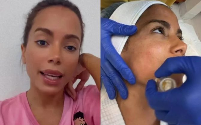 A cantora mostrou que seu sangue passa por um processo de separação dos glóbulos brancos e vermelhos, resultando em um líquido plasmático que é aplicado em sua pele com microagulhas. (Foto: Instagram)