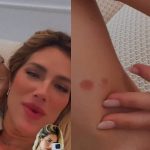 Giovanna Ewbank usou as redes sociais e se explicou após chamar a atenção ao surgir com um hematoma no braço. (Foto: Instagram)