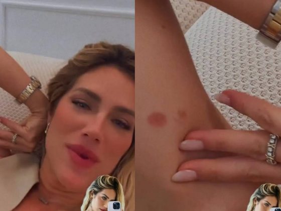 Giovanna Ewbank usou as redes sociais e se explicou após chamar a atenção ao surgir com um hematoma no braço. (Foto: Instagram)