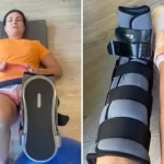 Fátima Bernardes abriu o jogo sobre como está lidando para o processo de recuperação após ter quebrado o pé. (Foto: Instagram)