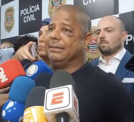 Marcelinho Carioca, com olho machucado, falou, em entrevista coletiva realizada nessa segunda-feira em São Paulo, sobre o sequestro que sofreu no último fim de semana. (Foto: Instagram)