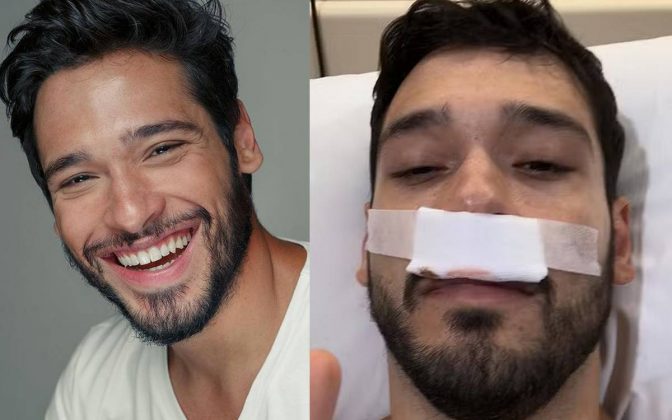 Bruno Fagundes atualiza estado de saúde após realizar cirurgia de emergência. (Foto: Instagram)