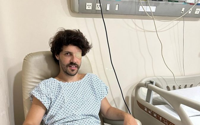 Diogo Defante diz que 'olho caído' era causado por um tumor: "Nenhum médico conseguia descobrir". (Foto: Instagram)