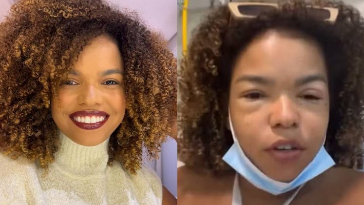 Jeniffer Nascimento desabafa após assustar fãs com reação alérgica: "Desesperador". (Foto: Instagram)