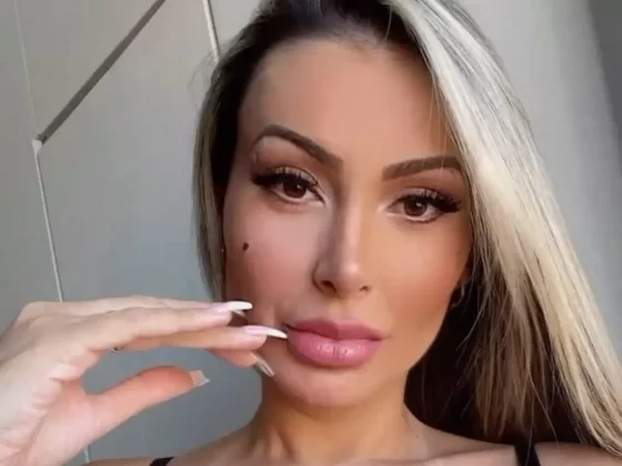 Andressa Urach relata fortes dores após procedimento que divide a língua: "Difícil". (Foto: Instagram)