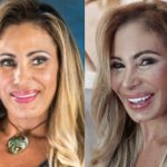 Ângela Bismarchi realiza lift facial: "O objetivo é rejuvenescer 20 anos" (Foto: Instagram)