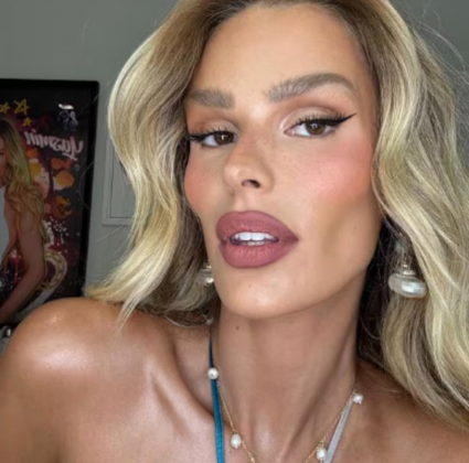 Yasmin Brunet surpreende ao aparecer mais magra. (Foto: Instagram)