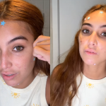 Vanessa Lopes compartilha luta contra acne: "Afeta a minha autoestima" (Foto Instagram)