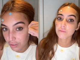 Vanessa Lopes compartilha luta contra acne: "Afeta a minha autoestima" (Foto Instagram)