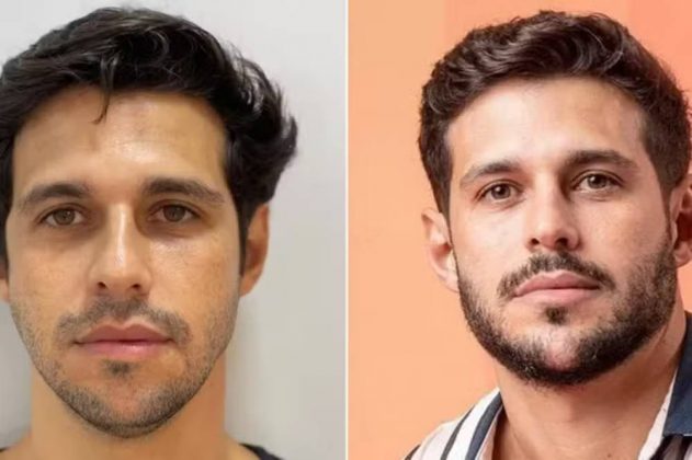 Antes de entrar no BBB22, Rodrigo Mussi, de 36 anos, fez preenchimentos com ácido hialurônico, além de um procedimento para projeção do queixo. (Foto Instagram)