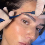 Deborah Secco faz transplante de sobrancelha. (Foto: Instagram)