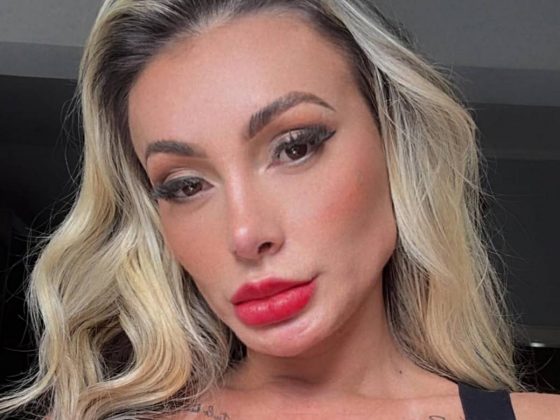 Andressa Urach cancela gravações de conteúdo íntimo e expõe problema de saúde: "Preciso cuidar". (Foto: Instagram)