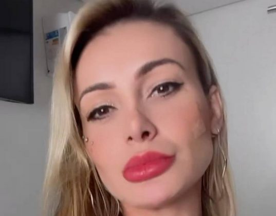 Andressa Urach interrompe gravações após procedimento nas partes íntimas. (Foto: Instagram)