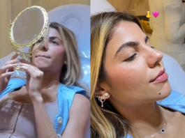 Hariany Almeida mostra resultado da rinoplastia: "Está lindinho" (Foto: Instagram)