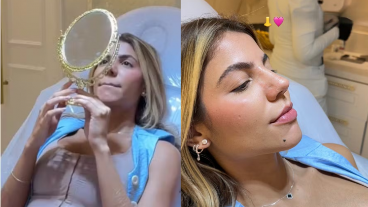 Hariany Almeida mostra resultado da rinoplastia: "Está lindinho" (Foto: Instagram)