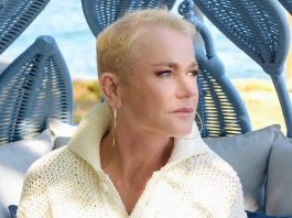 Assim como Xuxa, confira outros famosos que tem alopecia. (Foto Instagram)