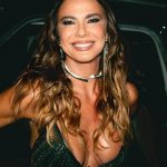 Luciana Gimenez relata desconforto após cirurgia. (Foto: Instagram)