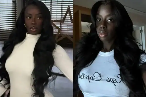 Influenciadora viraliza com sua beleza e revela luta por inclusão: “Nada vai mudar se a gente ficar calada”