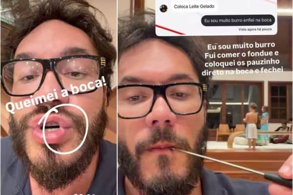 Eliezer sofre acidente doméstico e desabafa irritado na web: “Eu sou muito burro”