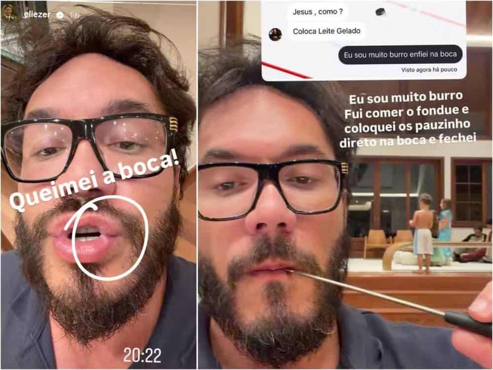 Eliezer sofre acidente doméstico e desabafa irritado na web: "Eu sou muito burro" (Foto: Instagram)