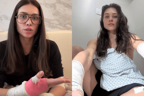 Flavia Pavanelli sofre acidente com box de vidro durante banho e leva 13 pontos: “Estilhaçou em mim”