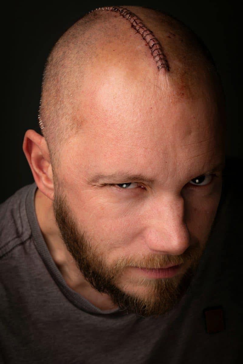 a bald man with a baseball on his head