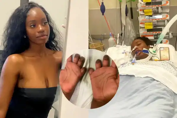 Aos 19 anos, ela pensou estar com uma virose e acordou após ter os dedos e as duas pernas amputadas