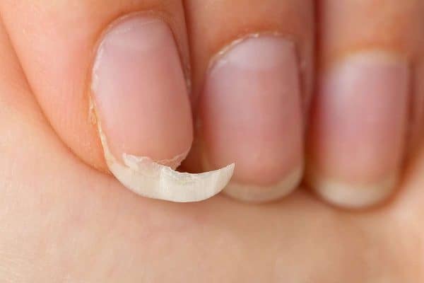 Como o hábito diário de usar água quente prejudica suas unhas sem você perceber