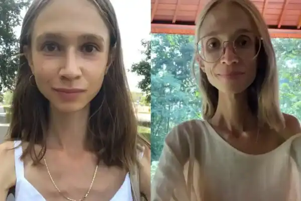 Dançarina de 27 anos morre pesando apenas 22 quilos após seguir dieta à base de frutas
